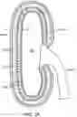 Fig. 05 - RENAL NERVE DENERVATION VIA THE RENAL PELVIS