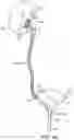 Fig. 08 - RENAL NERVE DENERVATION VIA THE RENAL PELVIS
