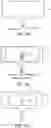 Fig. 09 - RENAL NERVE DENERVATION VIA THE RENAL PELVIS