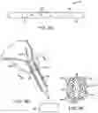 Fig. 13 - RENAL NERVE DENERVATION VIA THE RENAL PELVIS