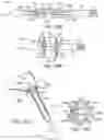 Fig. 15 - RENAL NERVE DENERVATION VIA THE RENAL PELVIS