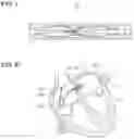 Fig. 05 - MEDICAL DEVICE
