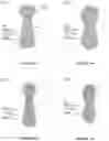 Fig. 07 - ABSORBENT INTIMATE HYGIENE PRODUCT FOR PREVENTING AND TREATING INFECTION