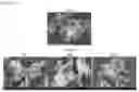 Fig. 40 - Dry powder formulations for inhalation