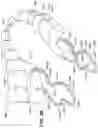 Fig. 16 - METHOD AND APPARATUS FOR TREATING SLEEP APNEA