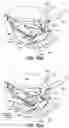 Fig. 30 - METHOD AND APPARATUS FOR TREATING SLEEP APNEA