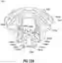 Fig. 34 - METHOD AND APPARATUS FOR TREATING SLEEP APNEA