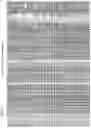 Fig. 04 - CD25 antibodies