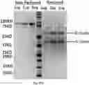 Fig. 122 - TUMOR ACTIVATED T CELL ENGAGERS AND METHODS OF USE THEREOF