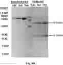 Fig. 74 - TUMOR ACTIVATED T CELL ENGAGERS AND METHODS OF USE THEREOF