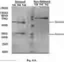 Fig. 84 - TUMOR ACTIVATED T CELL ENGAGERS AND METHODS OF USE THEREOF