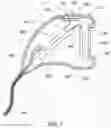 Fig. 07 - Systems, methods and devices for providing illumination in an endoscopic imaging environment