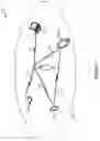 Fig. 02 - Early critical update indications for multi-link devices