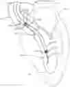 Fig. 01 - PERCUTANEOUS CIRCULATORY SUPPORT DEVICE INCLUDING GUIDEWIRE DISTAL TIP PORTION