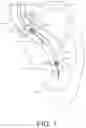 Fig. 02 - PERCUTANEOUS CIRCULATORY SUPPORT DEVICE INCLUDING GUIDEWIRE DISTAL TIP PORTION