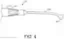 Fig. 04 - PERCUTANEOUS CIRCULATORY SUPPORT DEVICE INCLUDING GUIDEWIRE DISTAL TIP PORTION