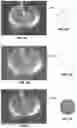 Fig. 06 - METHOD FOR MAKING MULTIPARTICULATES FROM A LIQUID FEED EMPLOYING A SPINNING DISC SPRAYER