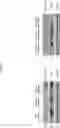 Fig. 05 - COMPOSITION FOR PREVENTING OR TREATING ALZHEIMER'S DISEASE COMPRISING INHIBITOR OF ATLASTIN 2, AND METHOD FOR DIAGNOSING ALZHEIMER'S DISEASE BY DETERMINING ATLASTIN 2
