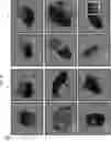 Fig. 09 - COMPOSITION FOR PREVENTING OR TREATING ALZHEIMER'S DISEASE COMPRISING INHIBITOR OF ATLASTIN 2, AND METHOD FOR DIAGNOSING ALZHEIMER'S DISEASE BY DETERMINING ATLASTIN 2