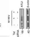 Fig. 32 - COMPOSITION FOR PREVENTING OR TREATING ALZHEIMER'S DISEASE COMPRISING INHIBITOR OF ATLASTIN 2, AND METHOD FOR DIAGNOSING ALZHEIMER'S DISEASE BY DETERMINING ATLASTIN 2