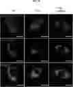Fig. 33 - COMPOSITION FOR PREVENTING OR TREATING ALZHEIMER'S DISEASE COMPRISING INHIBITOR OF ATLASTIN 2, AND METHOD FOR DIAGNOSING ALZHEIMER'S DISEASE BY DETERMINING ATLASTIN 2