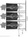 Fig. 05 - APPARATUS FOR PROVIDING A ROOT AIR GAP