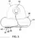 Fig. 04 - Audio Emitting Pillow Assembly