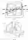 Fig. 02 - ORTHODONTIC APPLIANCES