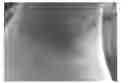 Fig. 01 - TOPICAL COMPOSITIONS FOR TREATING OR PREVENTING SCARS AND METHODS FOR THEIR USE