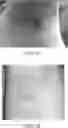 Fig. 02 - TOPICAL COMPOSITIONS FOR TREATING OR PREVENTING SCARS AND METHODS FOR THEIR USE