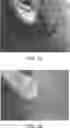 Fig. 04 - TOPICAL COMPOSITIONS FOR TREATING OR PREVENTING SCARS AND METHODS FOR THEIR USE