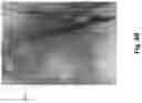 Fig. 06 - VENOUS COMPRESSION SITE IDENTIFICATION AND STENT DEPLOYMENT GUIDANCE, AND ASSOCIATED DEVICES, SYSTEMS, AND METHODS