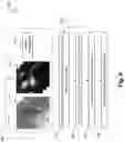 Fig. 09 - VENOUS COMPRESSION SITE IDENTIFICATION AND STENT DEPLOYMENT GUIDANCE, AND ASSOCIATED DEVICES, SYSTEMS, AND METHODS