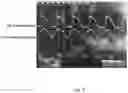 Fig. 03 - Dummy load control circuit and lighting device compatible with triac dimmer