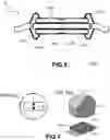 Fig. 03 - STACKED DIE ASSEMBLY