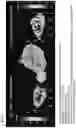 Fig. 20 - T-sensitive inversion-recovery imaging for EPROI