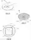 Fig. 06 - Umbilical Cord Stump Protector