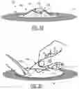 Fig. 07 - Umbilical Cord Stump Protector