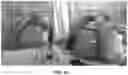 Fig. 22 - Fluid stimulation methods and devices for treating fluid overload