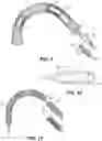Fig. 06 - Bending apparatus for coiled tubing