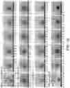 Fig. 33 - CHIMERIC ANTIGEN RECEPTOR CONSTRUCTS AND THEIR USE IN CAR-T CELLS