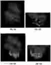 Fig. 26 - IDENTIFICATION OF BIOMIMETIC VIRAL PEPTIDES AND USES THEREOF