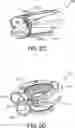 Fig. 09 - Turbocharger system for a two-stroke engine