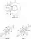 Fig. 02 - Determination Of The Concentration Of One Or More Substances In A Fluid