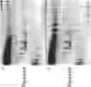 Fig. 07 - METHOD OF IDENTIFYING BIOMARKERS OF NEUROLOGICAL DISEASES AND DIAGNOSIS OF NEUROLOGICAL DISEASES
