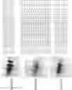 Fig. 08 - METHOD OF IDENTIFYING BIOMARKERS OF NEUROLOGICAL DISEASES AND DIAGNOSIS OF NEUROLOGICAL DISEASES