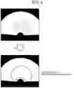 Fig. 04 - MEDICAL IMAGE PROCESSING APPARATUS, MEDICAL IMAGE PROCESSING METHOD, AND RECORDING MEDIUM