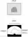 Fig. 05 - MEDICAL IMAGE PROCESSING APPARATUS, MEDICAL IMAGE PROCESSING METHOD, AND RECORDING MEDIUM