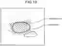 Fig. 09 - MEDICAL IMAGE PROCESSING APPARATUS, MEDICAL IMAGE PROCESSING METHOD, AND RECORDING MEDIUM