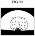Fig. 12 - MEDICAL IMAGE PROCESSING APPARATUS, MEDICAL IMAGE PROCESSING METHOD, AND RECORDING MEDIUM